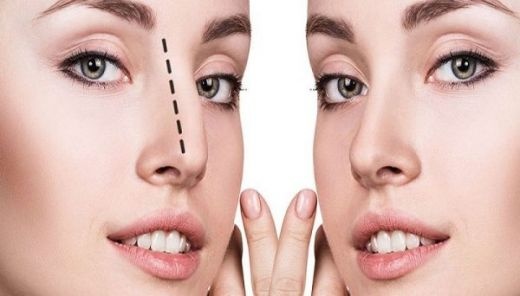 جراحی بینی | عمل بینی | پروتز سینه | پیکر تراشی