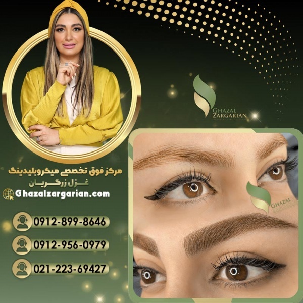 میکروبلیدینگ در مرکز غزل زرگریان