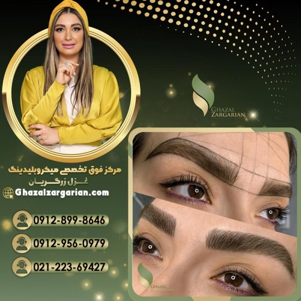 جدیدترین روش فیبروز با غزل زرگریان