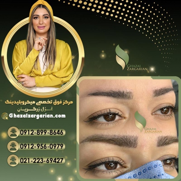 ریموو ابرو در مرکز میکروبلیدینگ غزل زرگریان